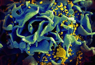 HIV infected t-cell.jpg